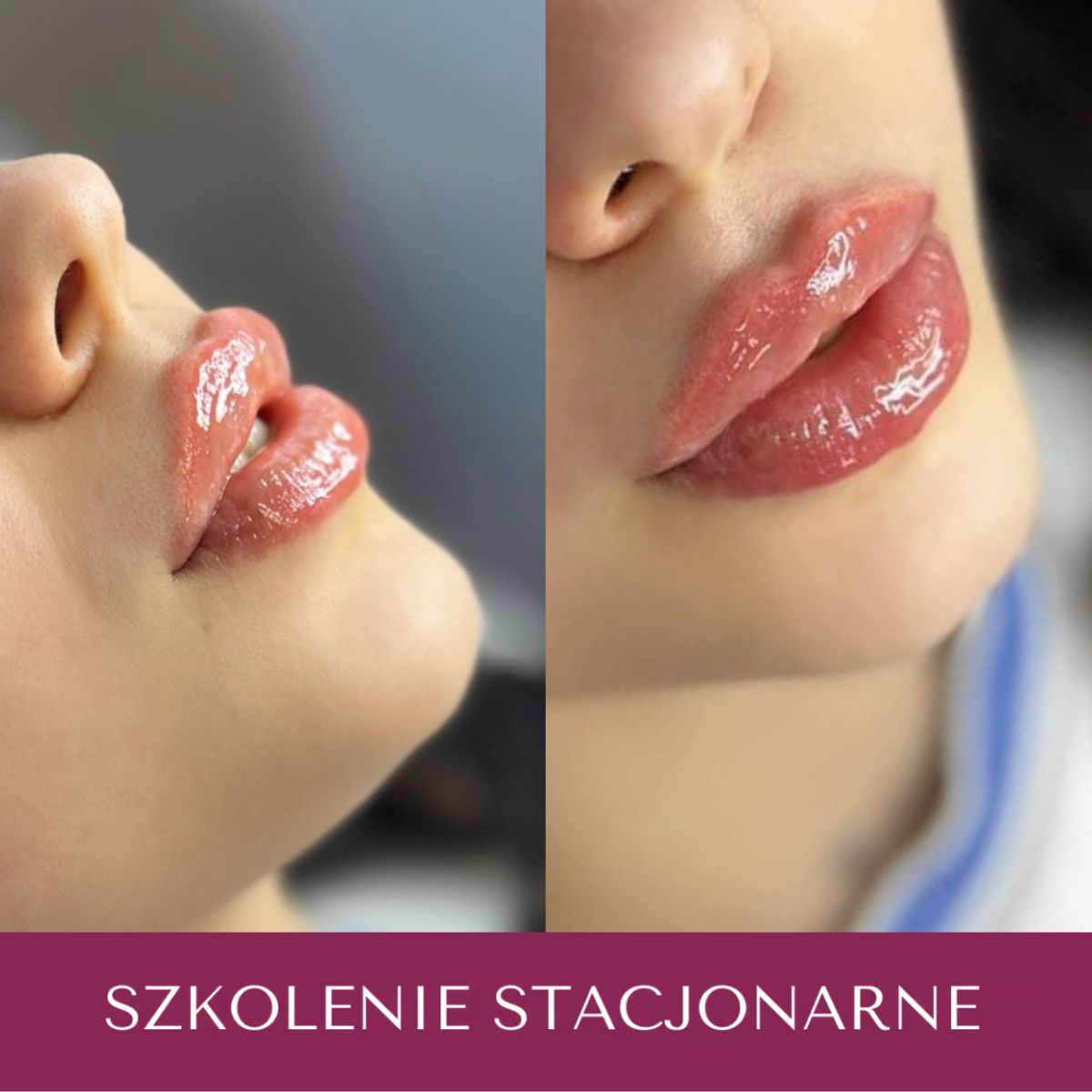 Modelowanie Ust na Eksperckim Poziomie - Usta Marzeń