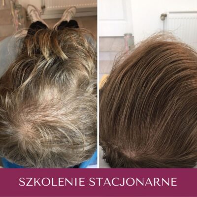 Szkolenie z podstaw Trychologii