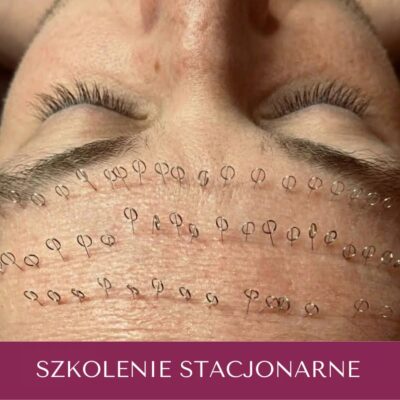 Szkolenie – Estetyczne Pinezkowanie Twarzy